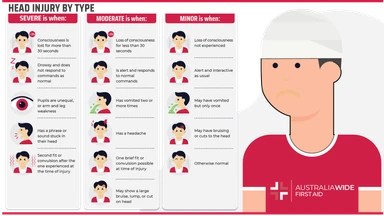 Child with an impact injury to the head